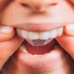 Person placing whitening strip on their teeth