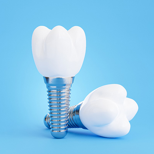 Two dental implants with crowns set against blue background