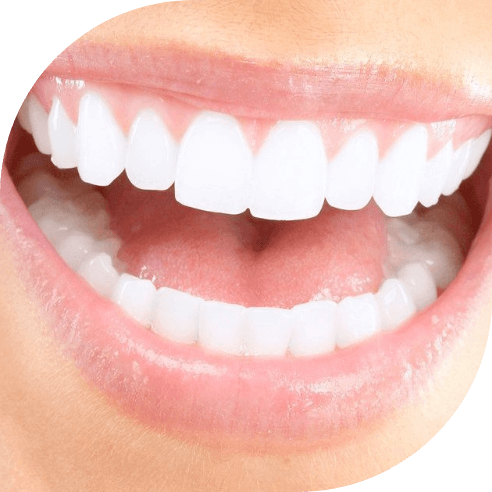 Closeup of flawless smile after Chao Pinhold Surgical Technique treatment